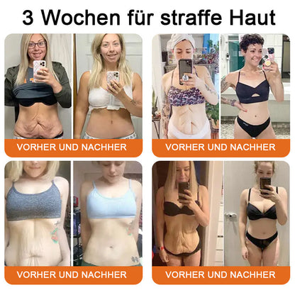🔥"Hergestellt in Deutschland, Versand aus Deutschland|✅ Offizieller Store✨Purelora® Bienengift Regenerationscreme 🔥 LETZTER TAG 80% RABATT💎"