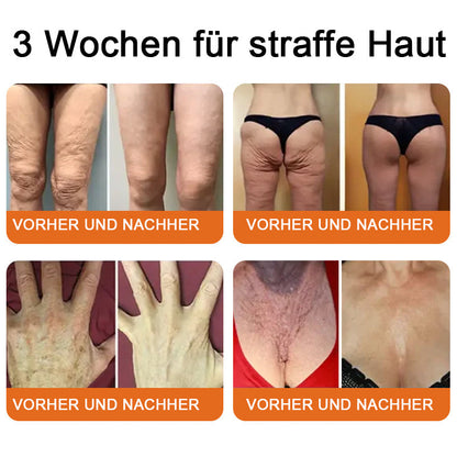 🔥"Hergestellt in Deutschland, Versand aus Deutschland|✅ Offizieller Store✨Purelora® Bienengift Regenerationscreme 🔥 LETZTER TAG 80% RABATT💎"