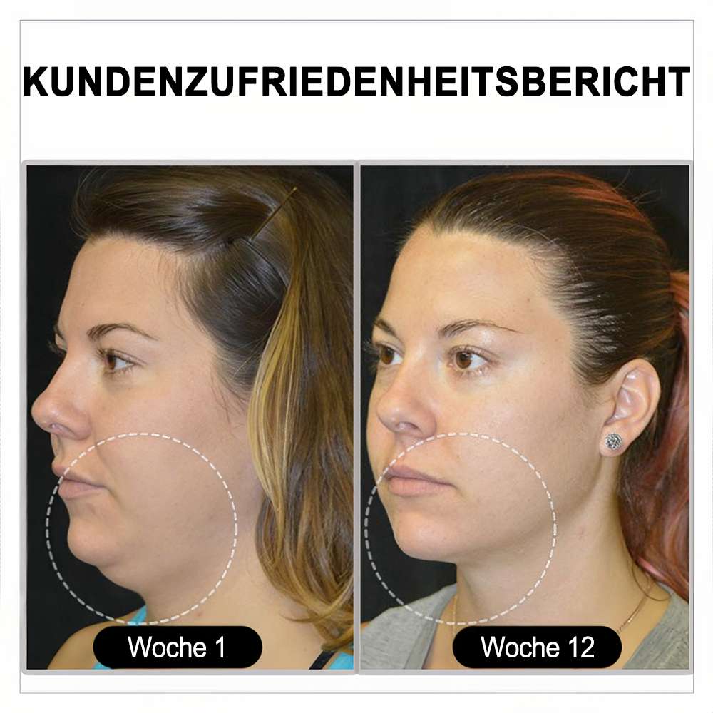 (🔥LETZTER TAG – 70 % RABATT) 🎉 Czticle® Histone Magnetologie Lymphvity Germanium-Ohrringe