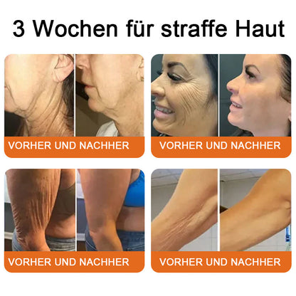 🔥"Hergestellt in Deutschland, Versand aus Deutschland|✅ Offizieller Store✨Purelora® Bienengift Regenerationscreme 🔥 LETZTER TAG 80% RABATT💎"