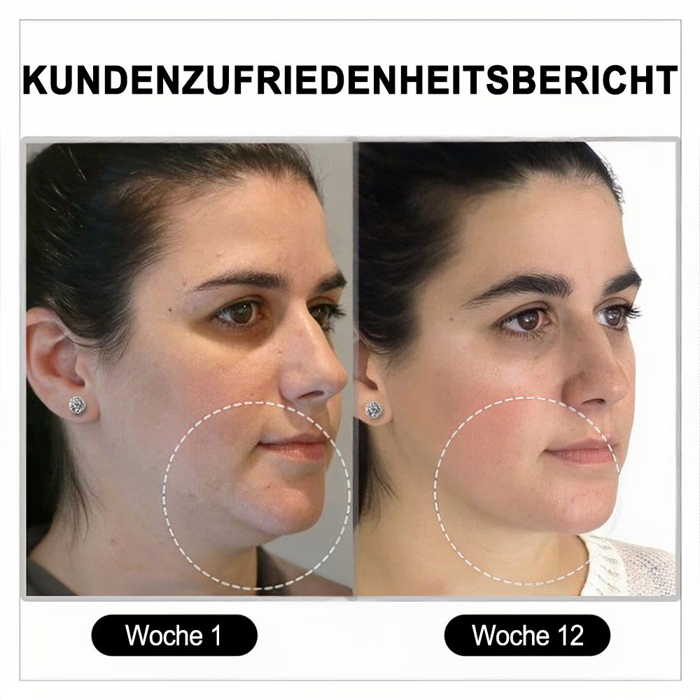(🔥LETZTER TAG – 70 % RABATT) 🎉 Czticle® Histone Magnetologie Lymphvity Germanium-Ohrringe