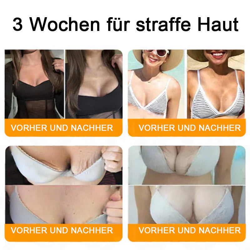 🔥"Hergestellt in Deutschland, Versand aus Deutschland|✅ Offizieller Store✨Purelora® Bienengift Regenerationscreme 🔥 LETZTER TAG 80% RABATT💎"