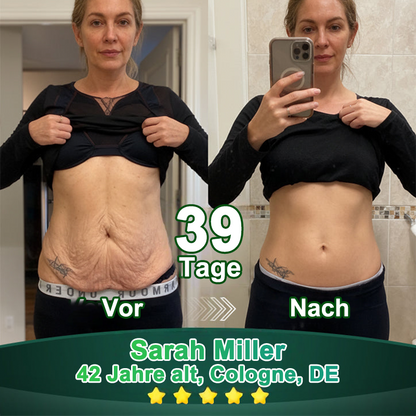 Purelora® Stammzellen-abgeleitetes EGF & Kupferpeptid-Aktivierungsserum (Aktiviert die Hauterneuerung von innen heraus für eine straffere, glattere Haut)（副本）