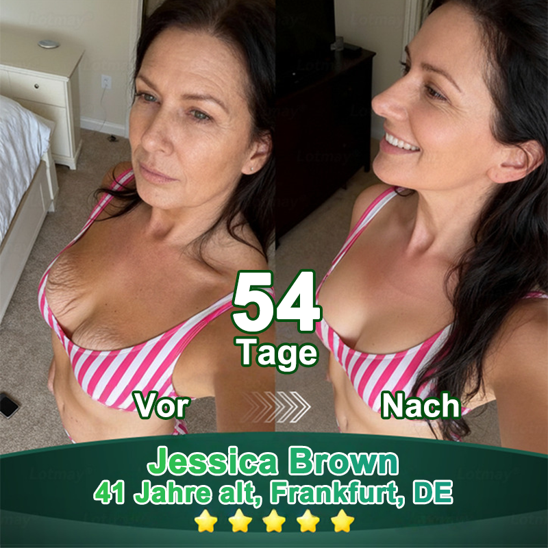 Purelora® Stammzellen-abgeleitetes EGF & Kupferpeptid-Aktivierungsserum (Aktiviert die Hauterneuerung von innen heraus für eine straffere, glattere Haut)（副本）