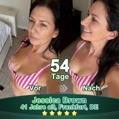 Purelora® Stammzellen-abgeleitetes EGF & Kupferpeptid-Aktivierungsserum (Aktiviert die Hauterneuerung von innen heraus für eine straffere, glattere Haut)（副本）