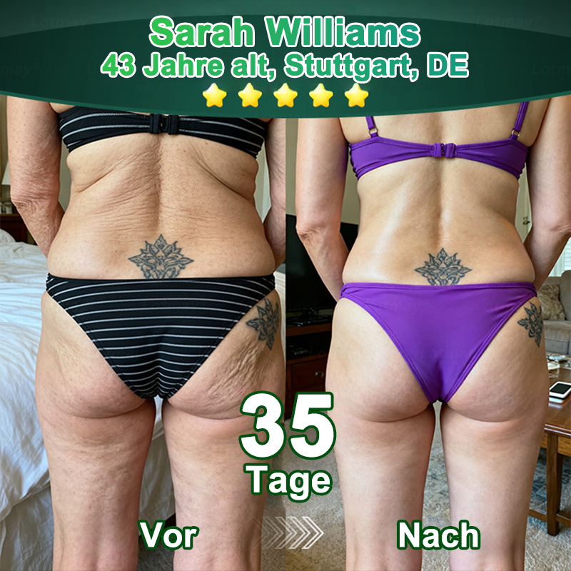Purelora® Stammzellen-abgeleitetes EGF & Kupferpeptid-Aktivierungsserum (Aktiviert die Hauterneuerung von innen heraus für eine straffere, glattere Haut)（副本）