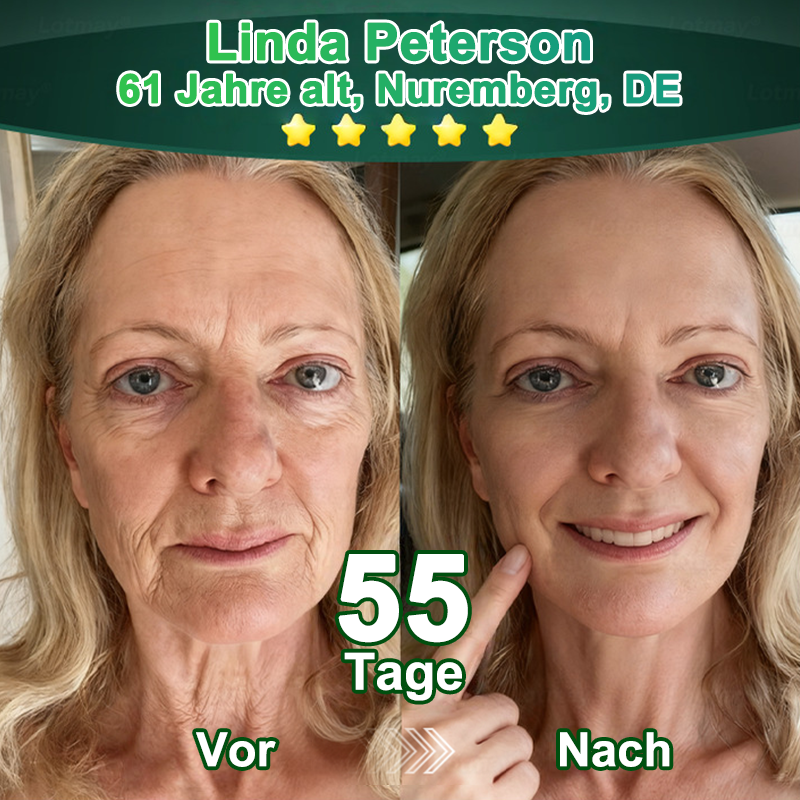 Purelora® Stammzellen-abgeleitetes EGF & Kupferpeptid-Aktivierungsserum (Aktiviert die Hauterneuerung von innen heraus für eine straffere, glattere Haut)（副本）