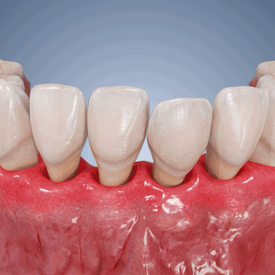💎 Purelora® GumRevive Parodontal-Reparaturgel