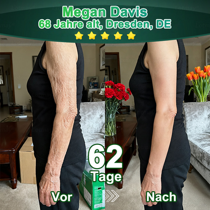 Purelora® Stammzellen-abgeleitetes EGF & Kupferpeptid-Aktivierungsserum (Aktiviert die Hauterneuerung von innen heraus für eine straffere, glattere Haut)（副本）