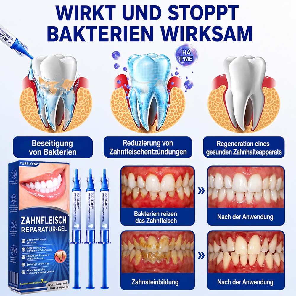 💎 Purelora® GumRevive Parodontal-Reparaturgel