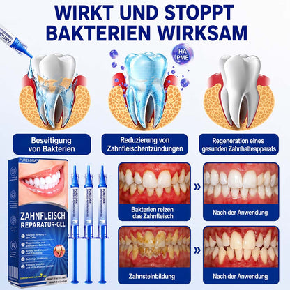💎 Purelora® GumRevive Parodontal-Reparaturgel