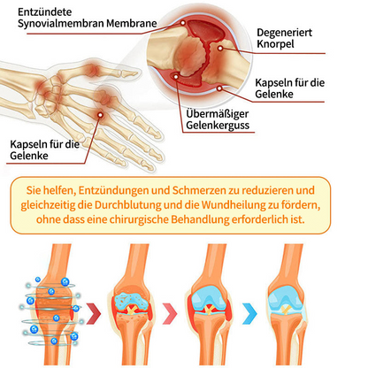 🐝 Offizieller Online-Shop丨Purelora® Bee Venom & Lithospermum Comfort Cream Wenn Gehen, Stehen oder Schlafen unangenehm wird — tägliche Schmerzlinderung & Knochenkomfort für ältere Erwachsene