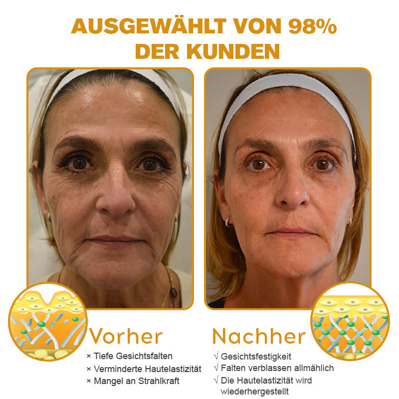 ✨Letzter Tag der Aktion: 70 % Rabatt - Purelora® Botox Bienenvenom Faltenentfernungscreme