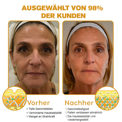 ✨Letzter Tag der Aktion: 70 % Rabatt - Purelora® Botox Bienenvenom Faltenentfernungscreme