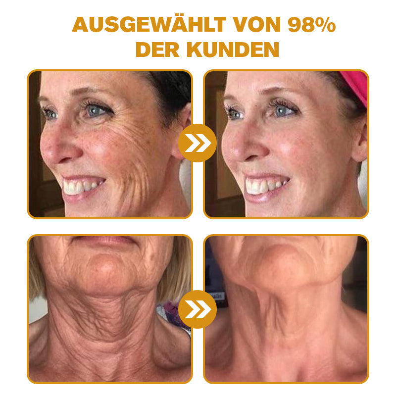 ✨Letzter Tag der Aktion: 70 % Rabatt - Purelora® Botox Bienenvenom Faltenentfernungscreme