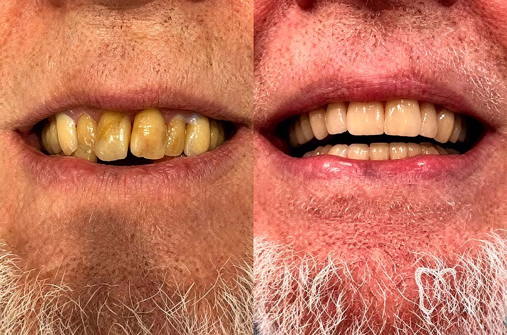 💎 Purelora® GumRevive Parodontal-Reparaturgel