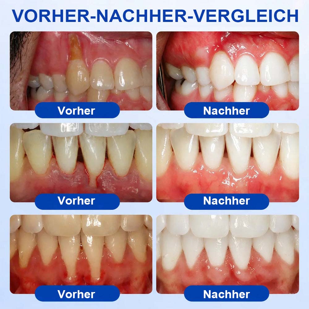 💎 Purelora® GumRevive Parodontal-Reparaturgel