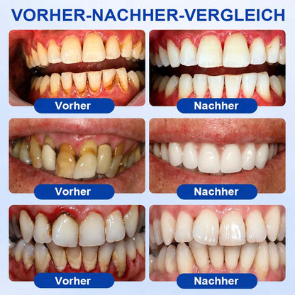 💎 Purelora® GumRevive Parodontal-Reparaturgel